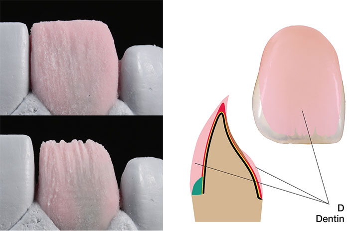 Dentin schichten
