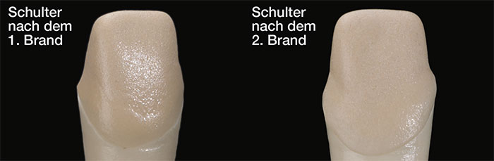Margin, Keramikschulter nach dem Brand