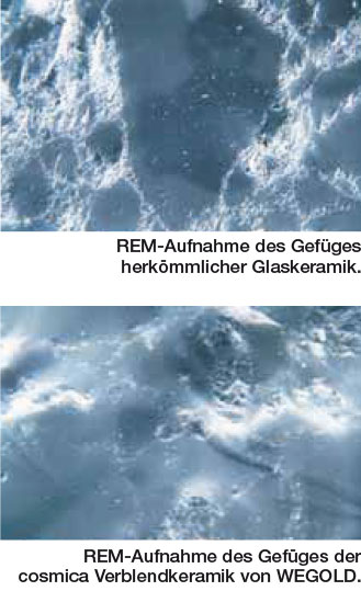 Keramische Verblendung REM-Mikroskop