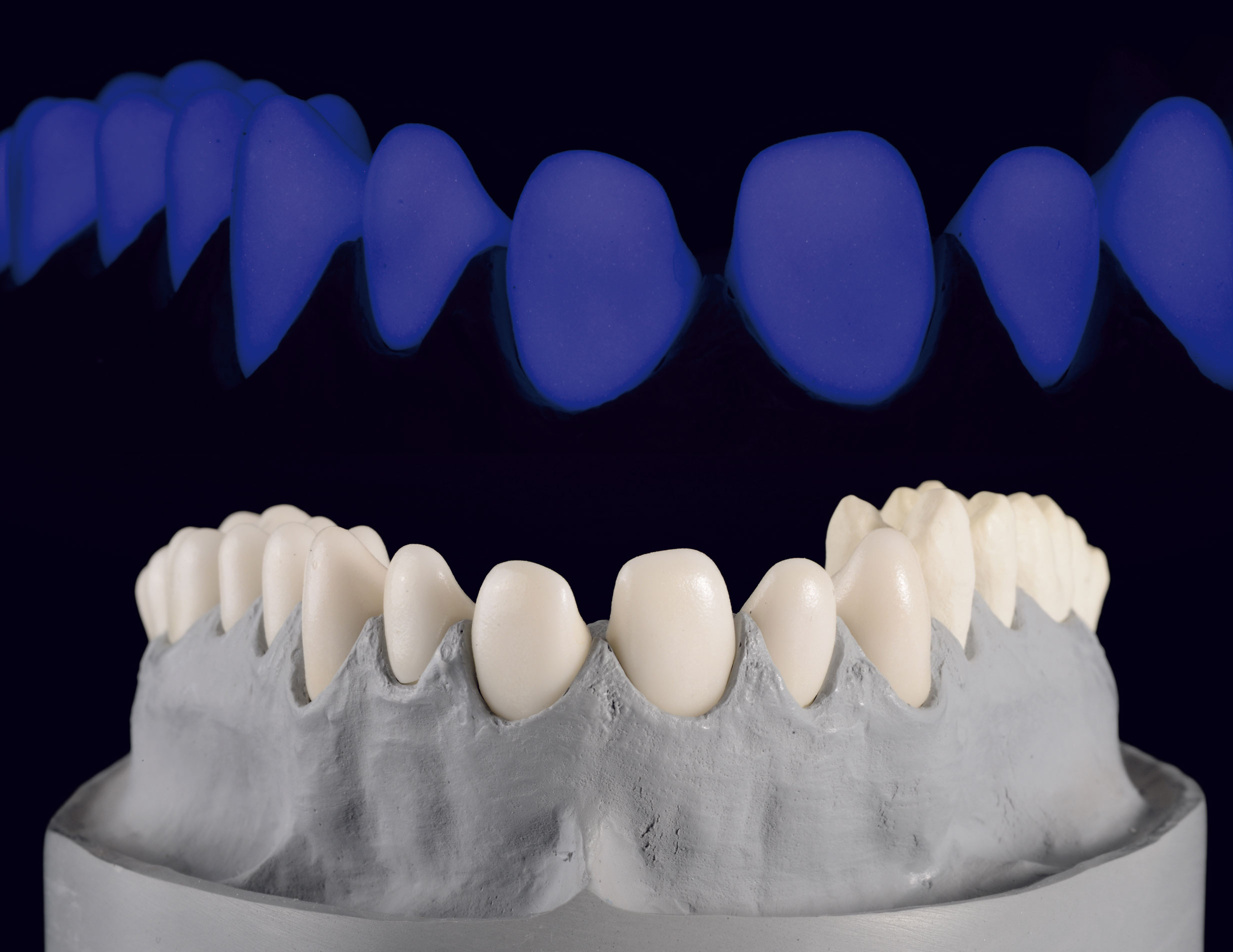 Liner fluorieszierend Dentalkeramik